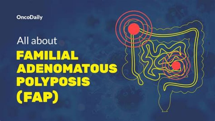 FAP Awareness: How an Idol's Voice Can Light Up the Path for Familial Adenomatous Polyposis Understanding
