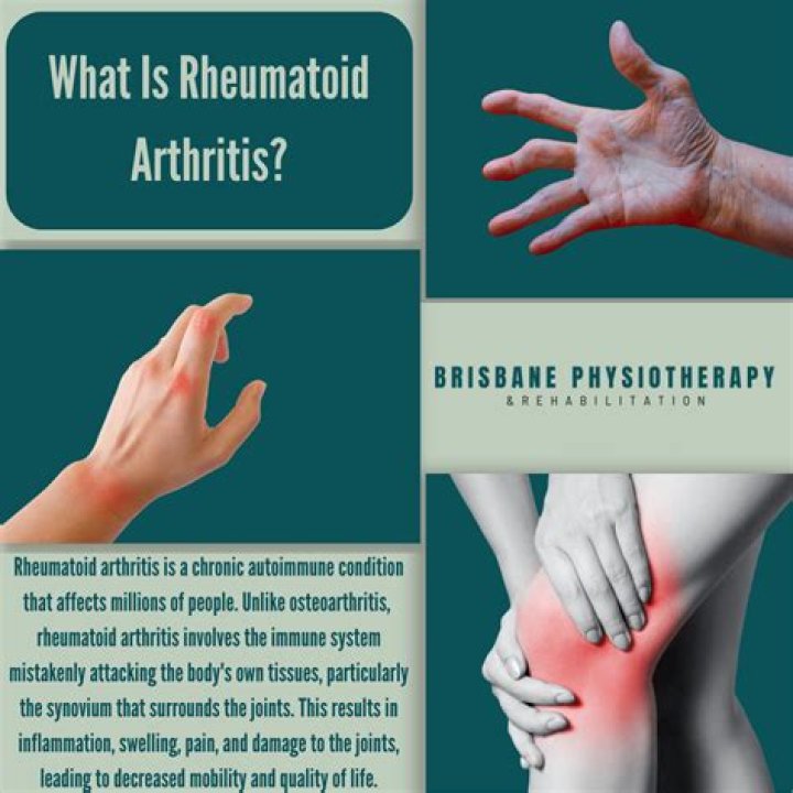 Understanding Rheumatoid Arthritis: What You Should Know About Steve Gerben and This Condition